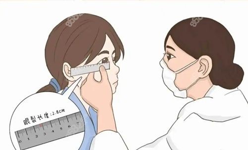 眼部整形金刀獎我國到底有幾個人