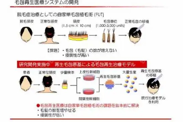 西昌恒美植发相关信息介绍