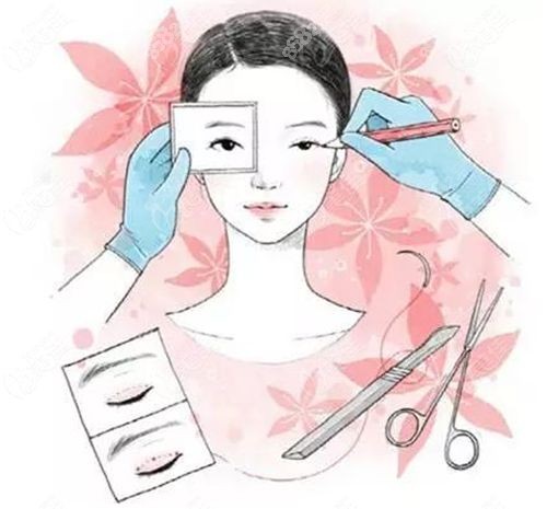 大連劉志剛眼修復(fù)好是真的靠譜 大連劉志剛眼修復(fù)好是真的靠譜