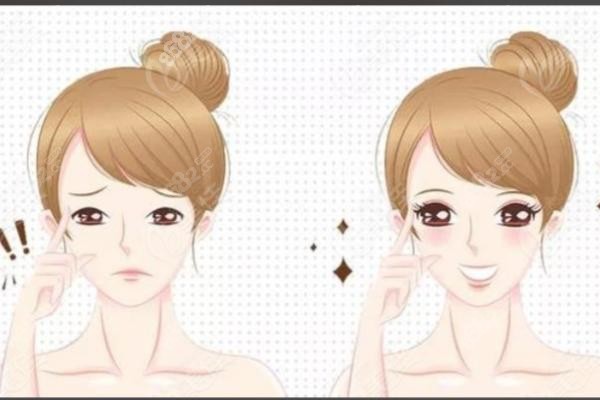 四、襄陽童顏伊美整形常見問題解答