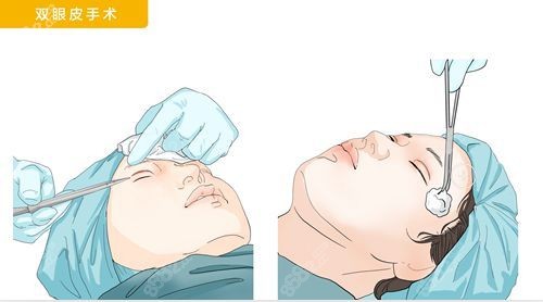 劉志剛醫(yī)生技術(shù)特色 劉志剛醫(yī)生技術(shù)特色