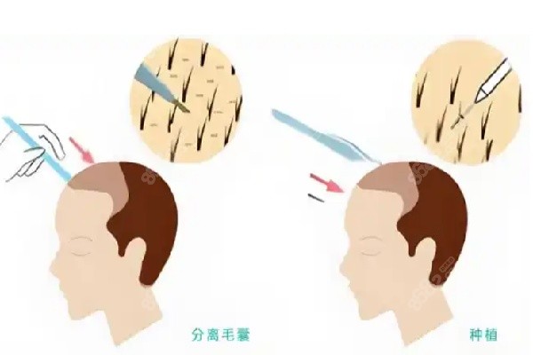 西昌恒美植发相关信息介绍
