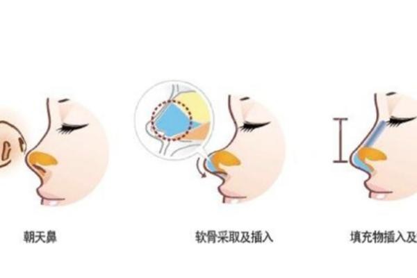 除了自然鼻，华颜还能做这些（安振东医生）