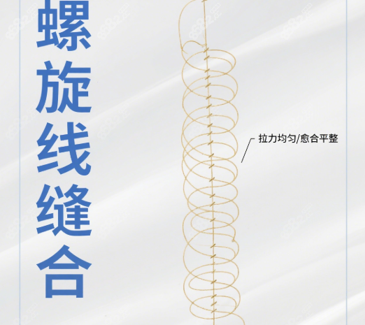 人中疤痕切除技术