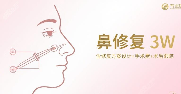 霍玉旺医生的鼻部整形实例分享