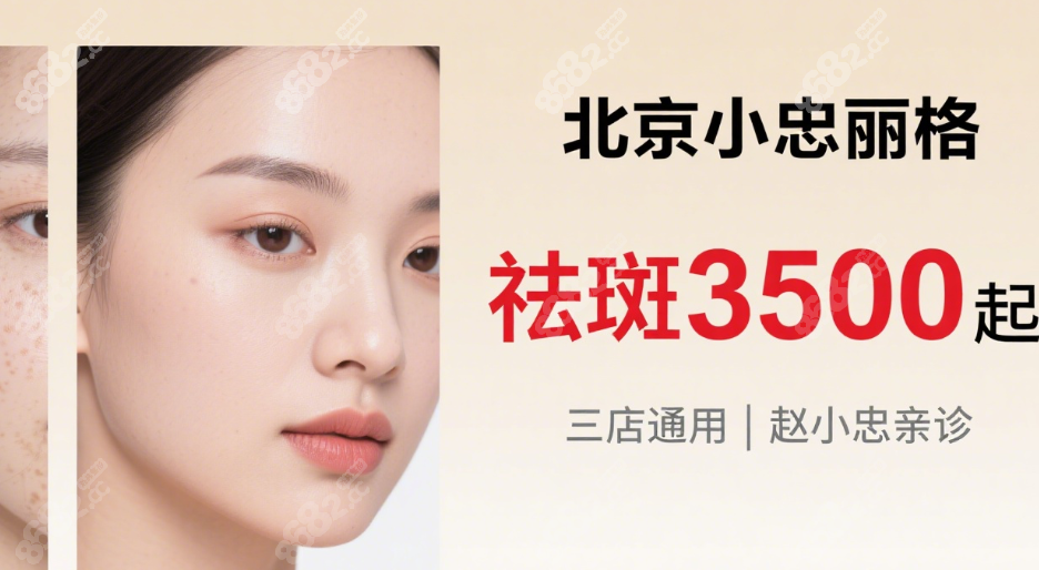 北京小忠丽格激光美容价格