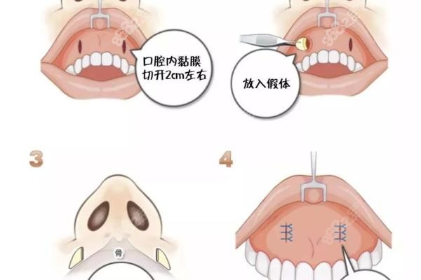 想预约安医生面诊？