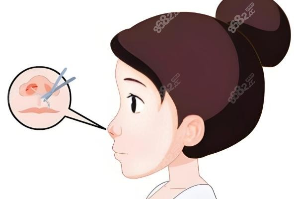 三、广州韩妃王涛正颌技术的就诊流程是怎样的？