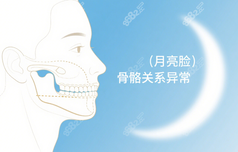 需要矫正的脸型