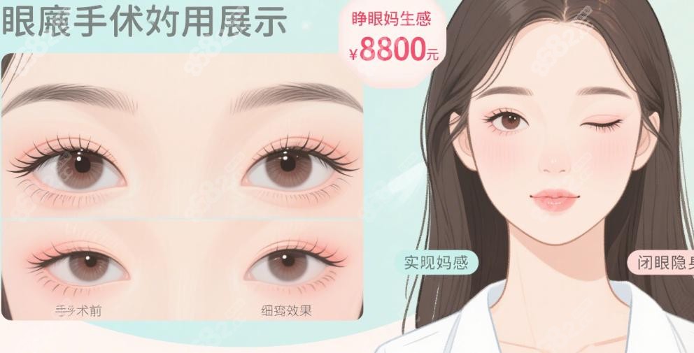 李瑞萱双眼皮多少钱