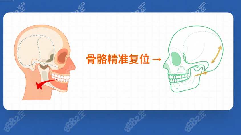 郑广森正颌手术价格www.8682.cc
