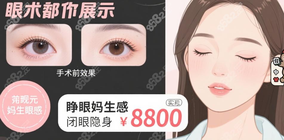 李瑞萱双眼皮手术成效如何
