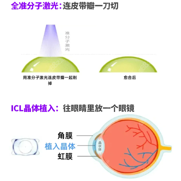 濟南市第二人民醫(yī)院近視眼手術收費多少？飛秒激光1.3萬起