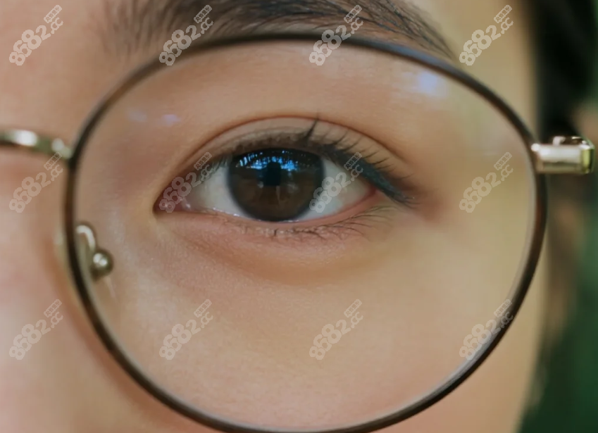 广西晶亮眼科全飞秒手术，优势显著