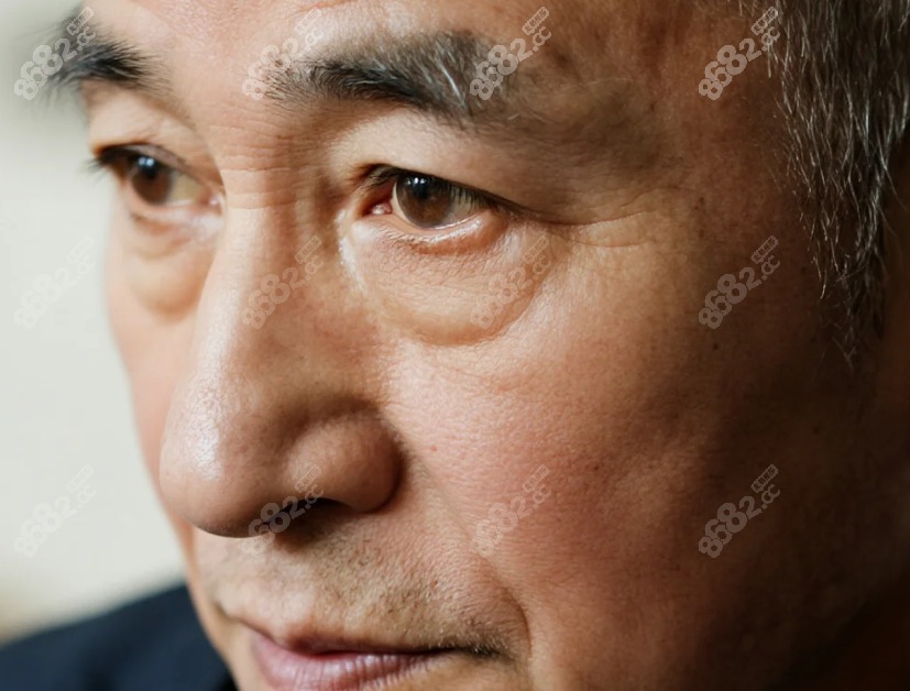 抚顺爱尔眼科白内障手术价格解析
