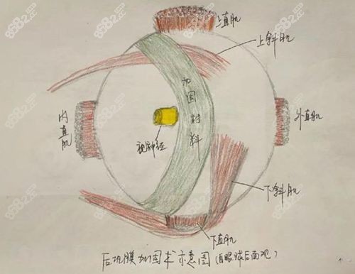 段安丽医生个人工作室在哪里?北京华德眼科(地址+电话+预约)