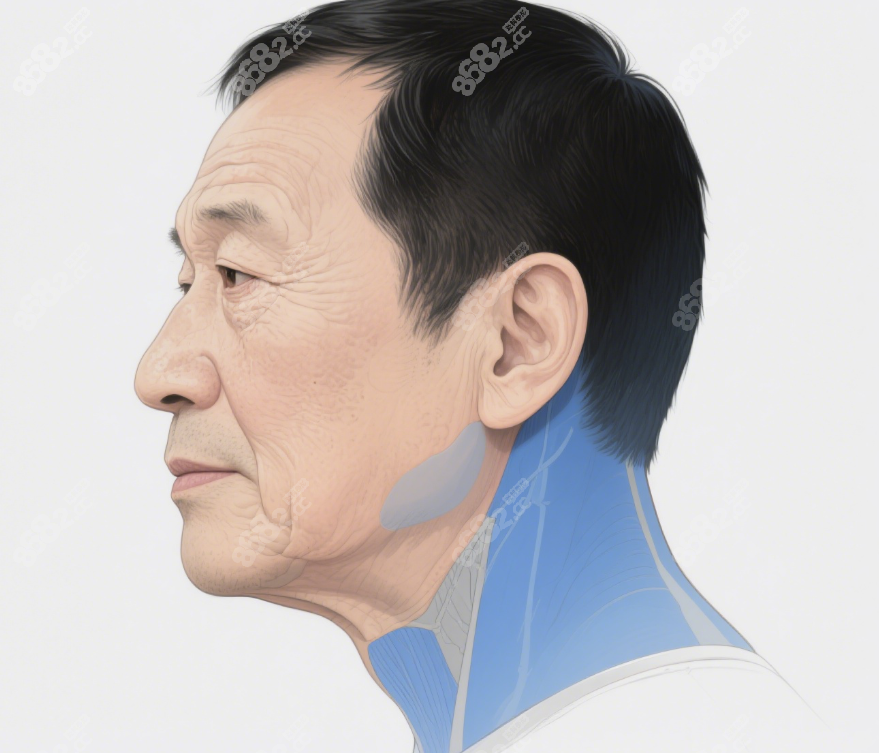 如何預(yù)約杜太超男生拉皮手術(shù)專屬方案www.ekelt.cn