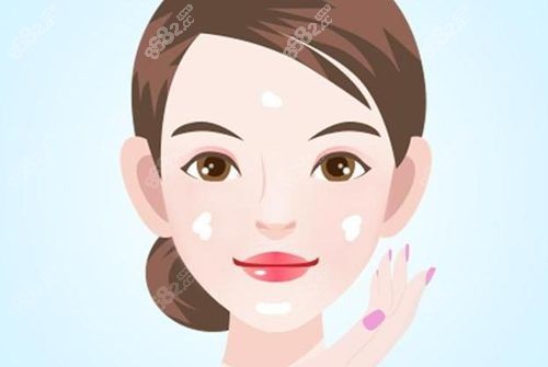 哪些人适合王阔远面部减容“微创抽吸”