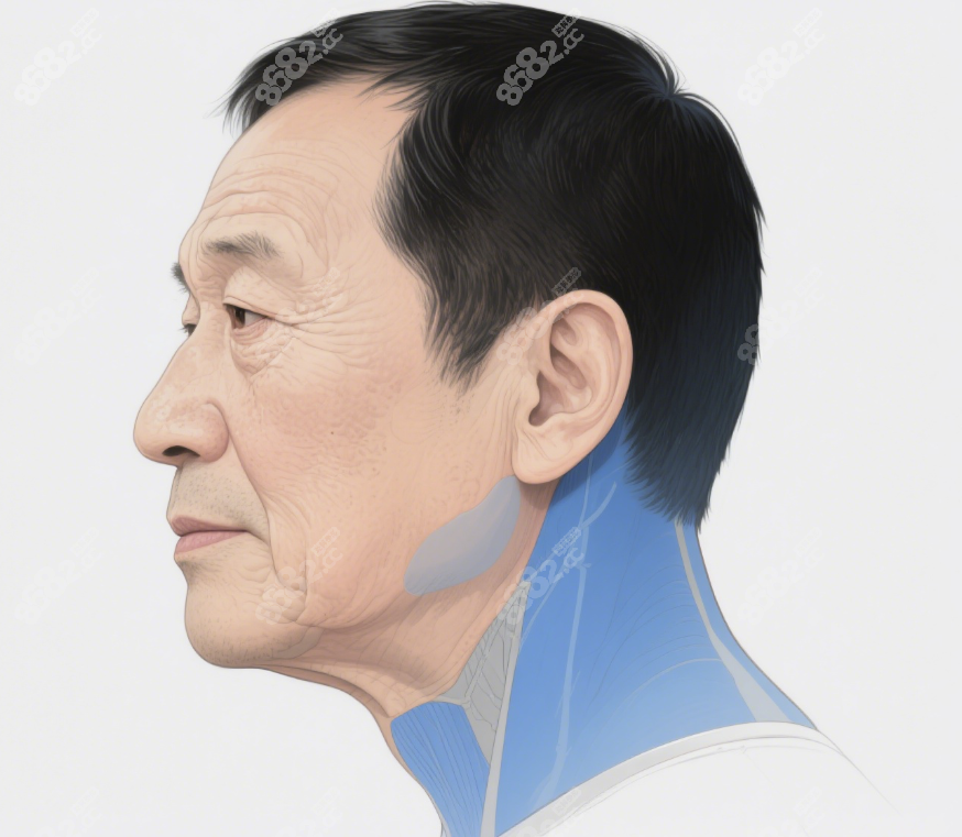 杜太超給男士做大拉皮除皺手術(shù)的技術(shù)亮點(diǎn)