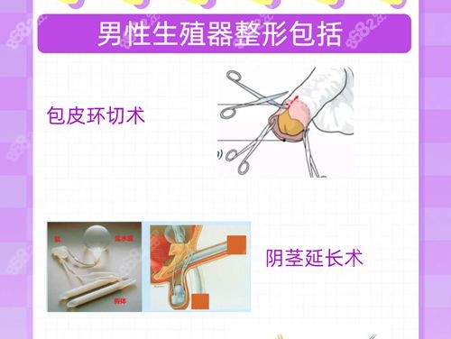 男性生殖整形医生吕巍:李世荣弟子,增粗增大技术好无黑料