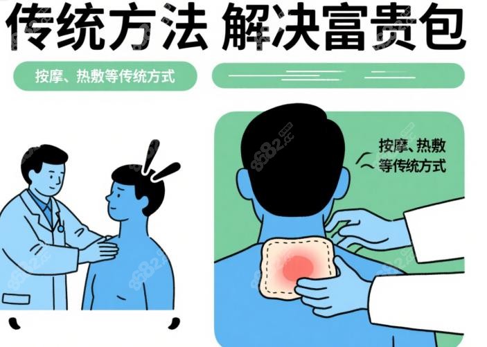 李方伟医生传统方法能解决富贵包吗