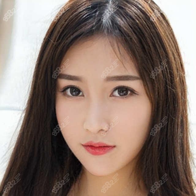 在宜昌打玻尿酸丰唇要多少钱？附靠谱医院清单和价格参考！