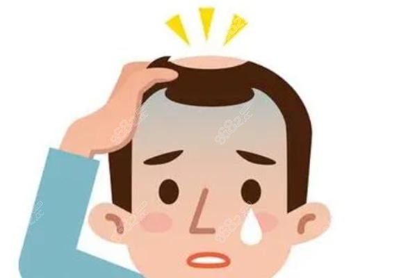 一、紹興金柯橋醫(yī)院植發(fā)科怎么樣？四大植發(fā)技術(shù)，滿足不同需求