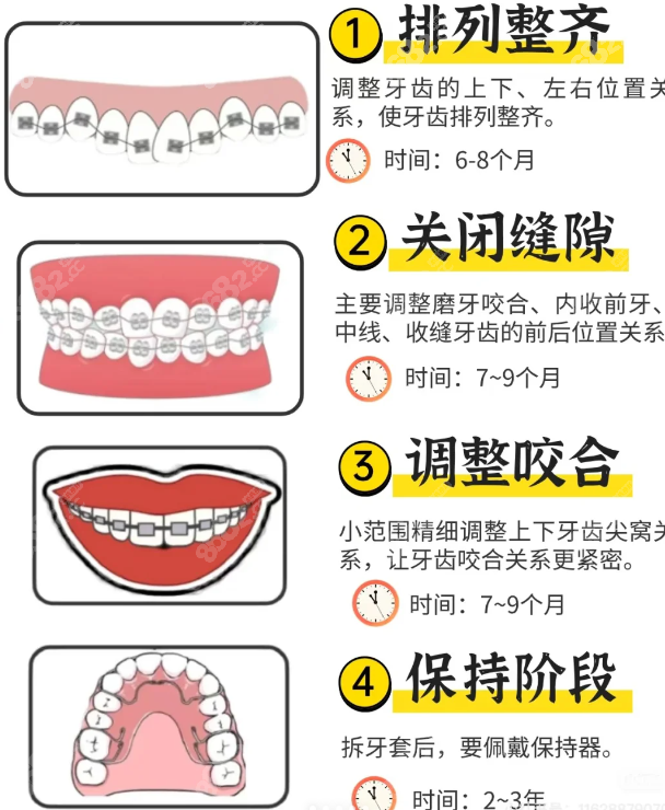 選擇正畸醫(yī)生和機構(gòu)的建議