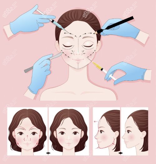 南京幼態(tài)臉打造微調誰家好？美萊/藝星幼態(tài)臉微調自然不僵，實例出圈！