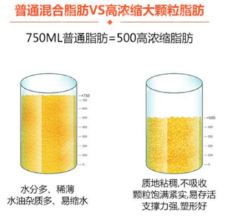 北京艺美硕德医疗脂肪专科技术怎么样