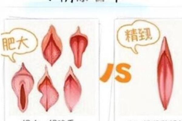 女性私密科1.jpg