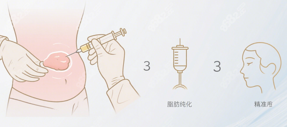 王明利医生脂肪填充优势