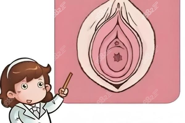  一、精致 “花瓣” 修護(hù)：告別摩擦不適，重獲自然美感