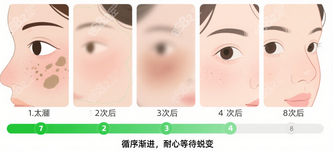 不同年龄治疗太田痣次数