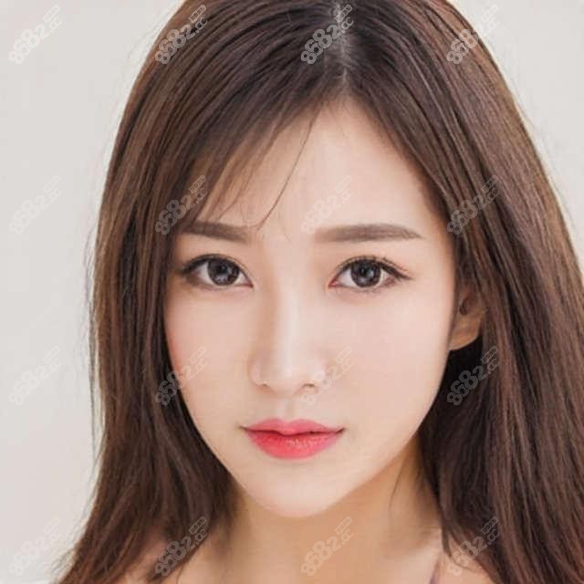 鄂尔多斯丰苹果肌价格多少?推荐鄂尔多斯实力机构:壹美天成医疗美容!