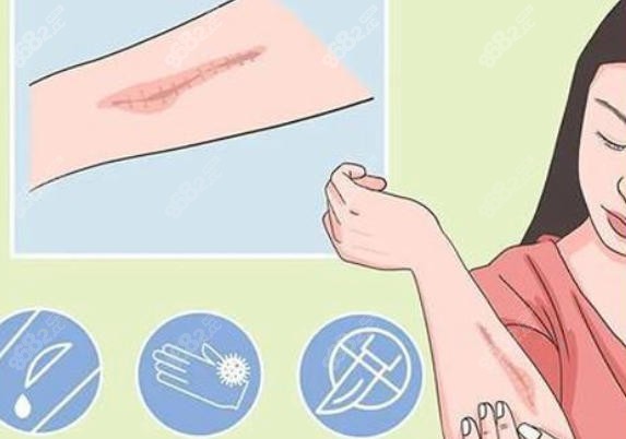二、超精细手术缝合：疤痕修复的技术亮点