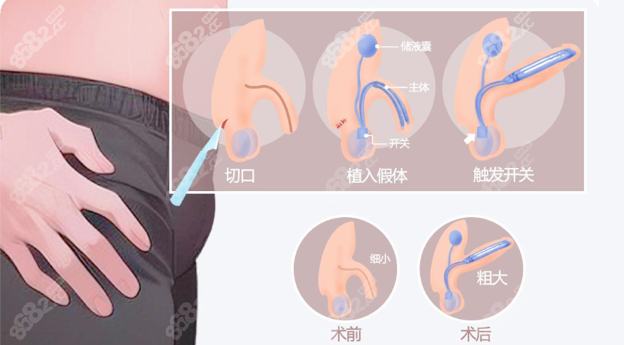 北京大学人民医院张国喜出诊时间