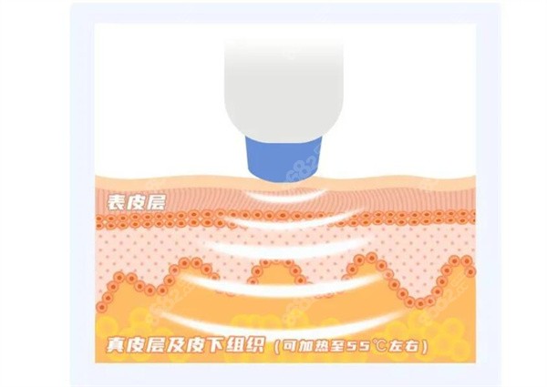 廣州紅十字會醫(yī)院祛斑價格2025全新：激光整形科價目表及醫(yī)生推薦攻略