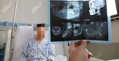 广州广大医院正颌手术预约后必做事项