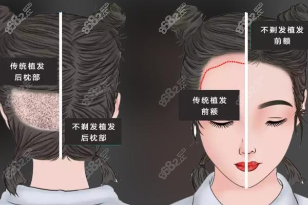 私立连锁植发机构