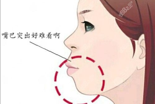广州广大医院正颌手术怎样预约？微信/官网 2 步约，提前 14 天锁定何锦泉