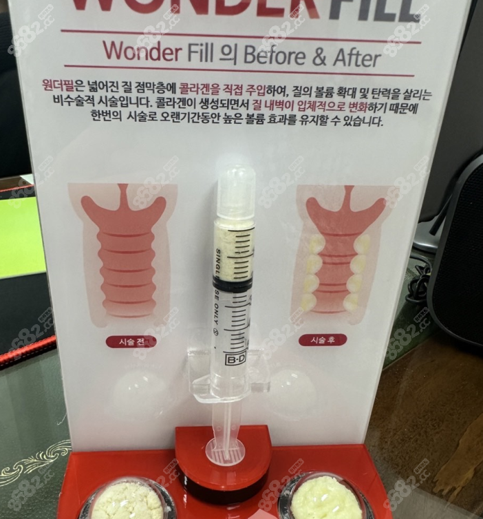 韩国千芊妍妇科 8682.cc