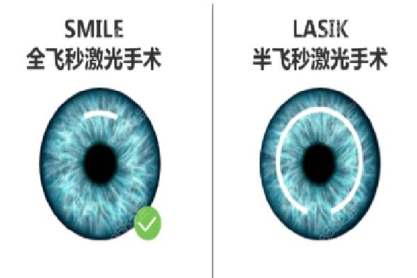 成都华厦眼科医院是否正规