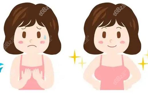 二、隆胸手术知识大科普