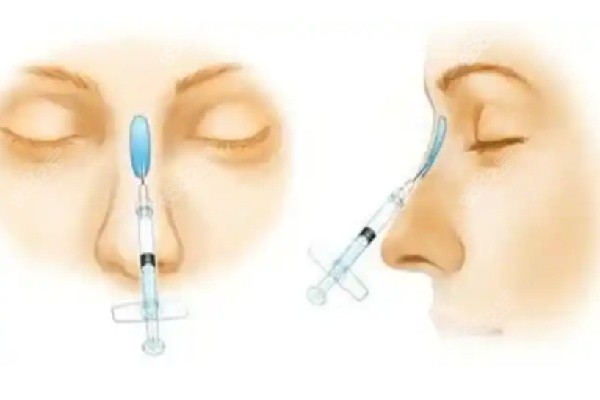 深圳阳光医院收费价目表