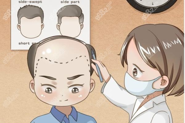 鄭州植發(fā)醫(yī)院排名大揭秘