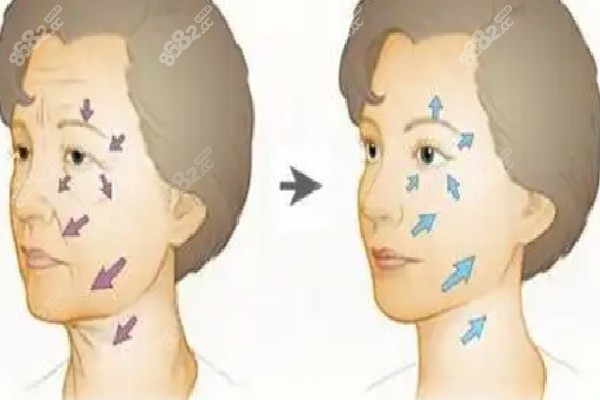 广州伊妍仕少女针授权医院排名情况如何 广州伊妍仕少女针授权医院排名情况如何