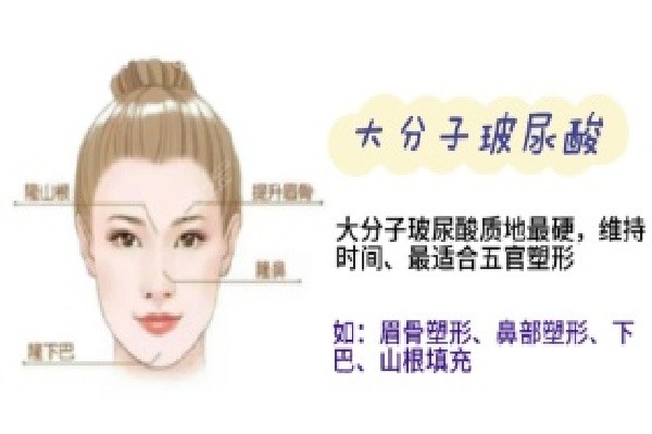 广东韩妃整形外科医院——伊妍仕少女针认证实力 广东韩妃整形外科医院——伊妍仕少女针认证实力