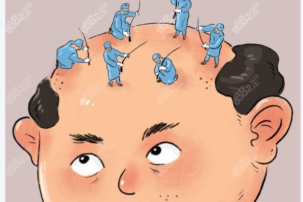 深圳碧蓮盛植發(fā)價(jià)目大起底