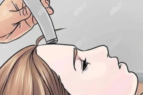 三、光子嫩膚各階段的治療頻率建議